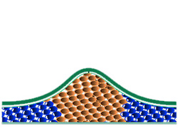 cryolipolyse schritt1