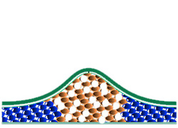 cryolipolyse schritt2